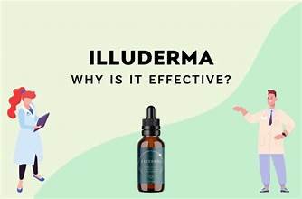 illuderma - الصورة 6